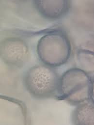 Attēlu rezultāti vaicājumam “Comatricha laxa macro”