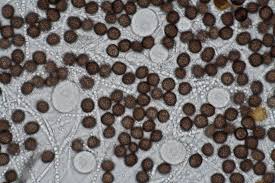 Attēlu rezultāti vaicājumam “Badhamia utricularis spores”