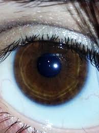 Kuvahaun tulos haulle Kayser-Fleischer