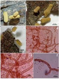 Attēlu rezultāti vaicājumam “Arcyria minuta spores”