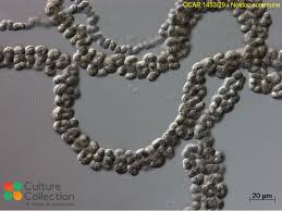 Attēlu rezultāti vaicājumam “Nostoc commune”