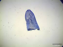 Attēlu rezultāti vaicājumam “Sphagnum warnstorfii”
