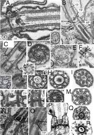 Attēlu rezultāti vaicājumam “Symphytocarpus impexus plasmodium”