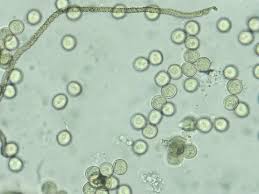 Attēlu rezultāti vaicājumam “Trichia contorta spores”