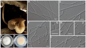 Attēlu rezultāti vaicājumam “Fuligo gyrosa spores”
