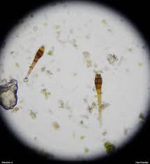 Attēlu rezultāti vaicājumam “Gyroweisia tenuis”