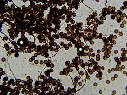 Attēlu rezultāti vaicājumam “Diderma chondrioderma”