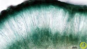 Attēlu rezultāti vaicājumam “Scoliciosporum chlorococcum”