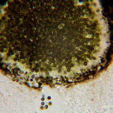 Attēlu rezultāti vaicājumam “Lichenoconium xanthoriae”