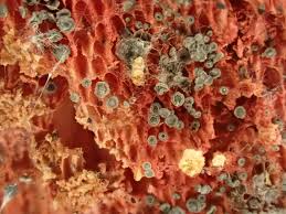 Attēlu rezultāti vaicājumam “Hyphodiscus hymeniophilus”