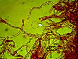 Attēlu rezultāti vaicājumam “Sarcoscypha austriaca var. lutea”