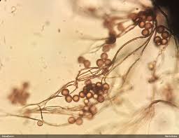 Attēlu rezultāti vaicājumam “Diderma subincarnatum”