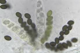 Attēlu rezultāti vaicājumam “Sordaria fimicola”