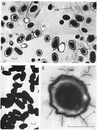 Attēlu rezultāti vaicājumam “Enteridium liceoides spores”