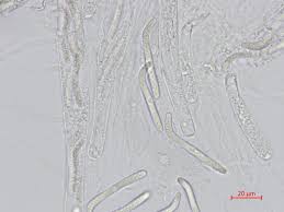 Attēlu rezultāti vaicājumam “Lasiosphaeria ovina spores”