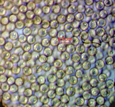 Attēlu rezultāti vaicājumam “Stemonitopsis hyperopta var. landewaldii macro”