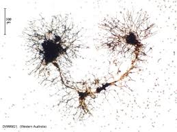 Attēlu rezultāti vaicājumam “Perichaena corticalis”