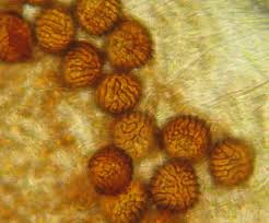 Attēlu rezultāti vaicājumam “Fossombronia wondraczekii”