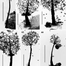 Attēlu rezultāti vaicājumam “Clastoderma debaryanum spores”