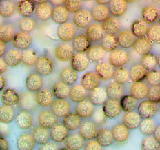 Attēlu rezultāti vaicājumam “Lycogala ustulatum sessile”