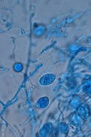 Attēlu rezultāti vaicājumam “Colloderma oculatum sessile”