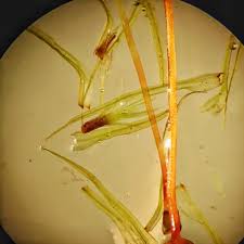 Attēlu rezultāti vaicājumam “Bartramia pomiformis sporophyte”