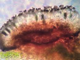 Attēlu rezultāti vaicājumam “Calicium salicinum”