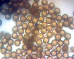 Attēlu rezultāti vaicājumam “Diachea subsessilis spores”