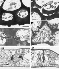 Attēlu rezultāti vaicājumam “Harpanthus flotovianus cells”