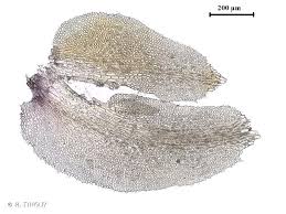 Attēlu rezultāti vaicājumam “Diplophyllum albicans”