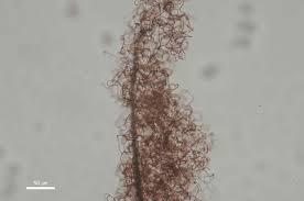 Attēlu rezultāti vaicājumam “Comatricha elegans var. microspora spores”