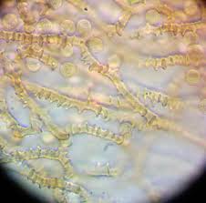 Attēlu rezultāti vaicājumam “Heterotrichia oerstedii (syn. Arcyria oerstedii) macro”
