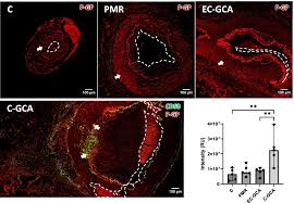 Image result for GCA