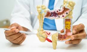 Image result for boala crohn si schizofrenie paranoida