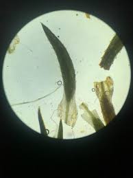 Attēlu rezultāti vaicājumam “Pogonatum dentatum”