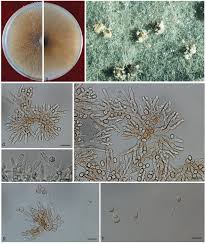 Attēlu rezultāti vaicājumam “Ophiostoma polyporicola”