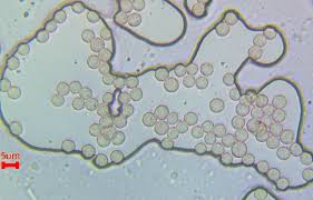 Attēlu rezultāti vaicājumam “Stemonitopsis gracilis”