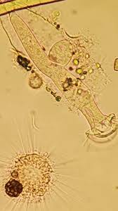 Attēlu rezultāti vaicājumam “Comatricha elegans var. microspora macro”