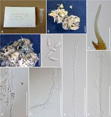 Attēlu rezultāti vaicājumam “Tilachlidium brachiatum”