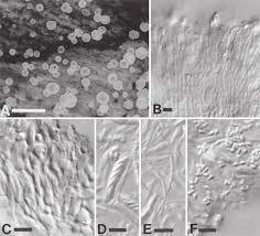 Attēlu rezultāti vaicājumam “Hyphodiscus hymeniophilus”