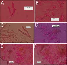 Attēlu rezultāti vaicājumam “Biatoropsis usnearum”