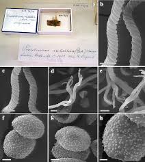 Attēlu rezultāti vaicājumam “Oligonema favogineum spores”