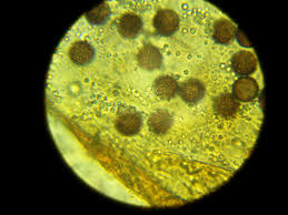 Attēlu rezultāti vaicājumam “Physarum contextum spores”