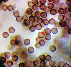 Attēlu rezultāti vaicājumam “Lycogala cf. fossiculatum”