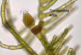 Attēlu rezultāti vaicājumam “Trentepohlia sp.”