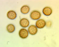Attēlu rezultāti vaicājumam “Symphytocarpus trechisporus macro”