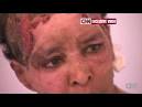 Wife Aline Skaf Burn and