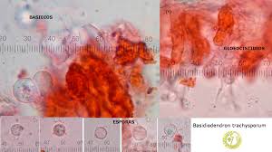 Attēlu rezultāti vaicājumam “Basidiodendron”