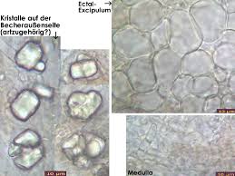 Attēlu rezultāti vaicājumam “Myriosclerotinia scirpicola”