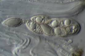 Attēlu rezultāti vaicājumam “Parmeliella triptophylla”